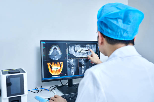 Best Emergency Wisdom Teeth Removal in Walker, MI