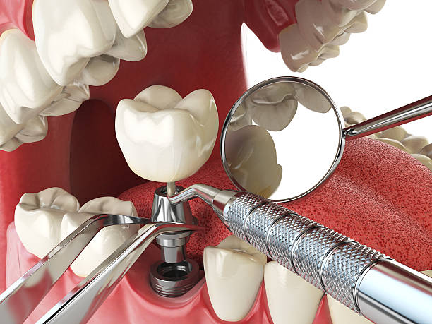 Best Cosmetic Emergency Dentistry in Walker, MI